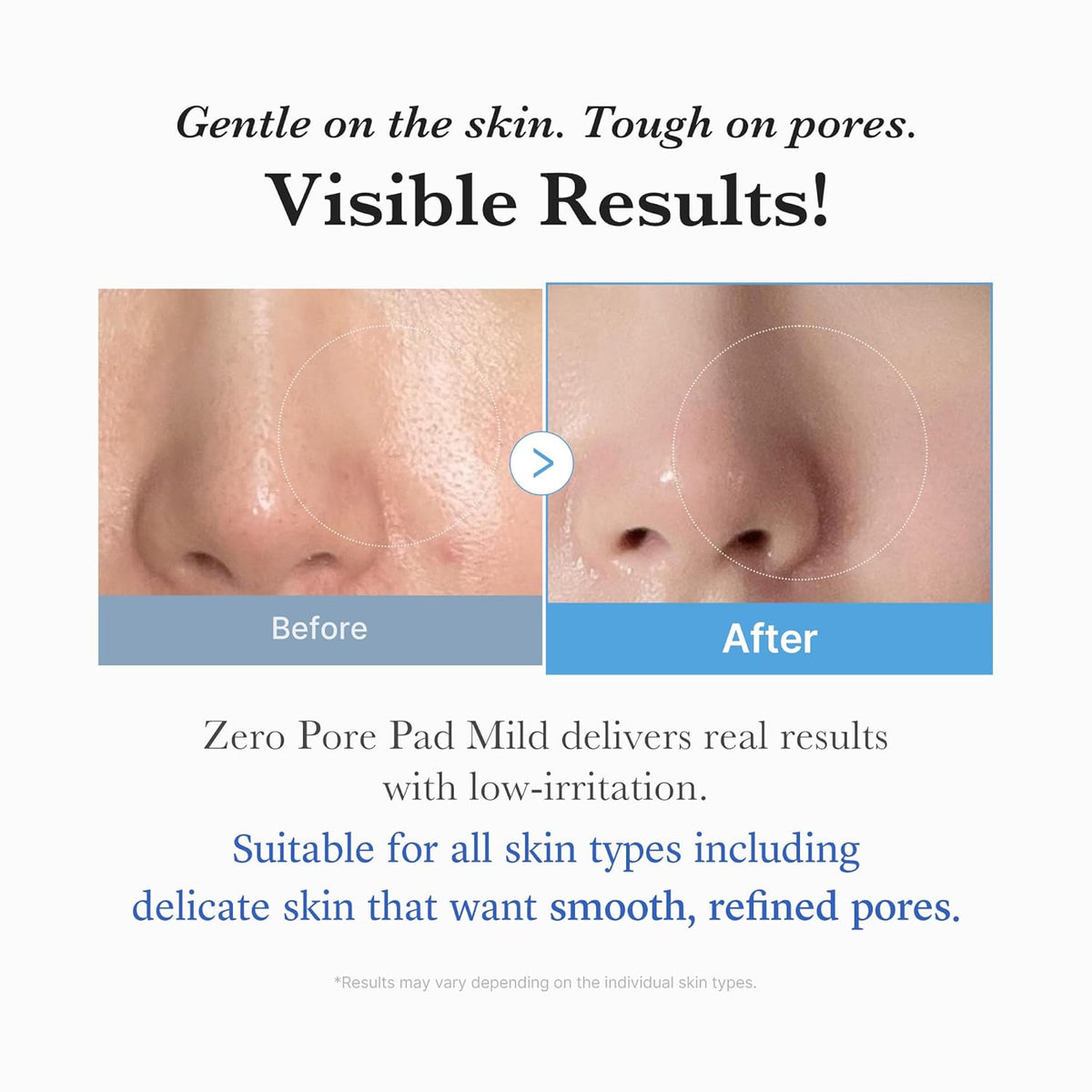 medicube Toner Pads Zero Pore Pad Mild 2.0 for Gentle Exfoliating
