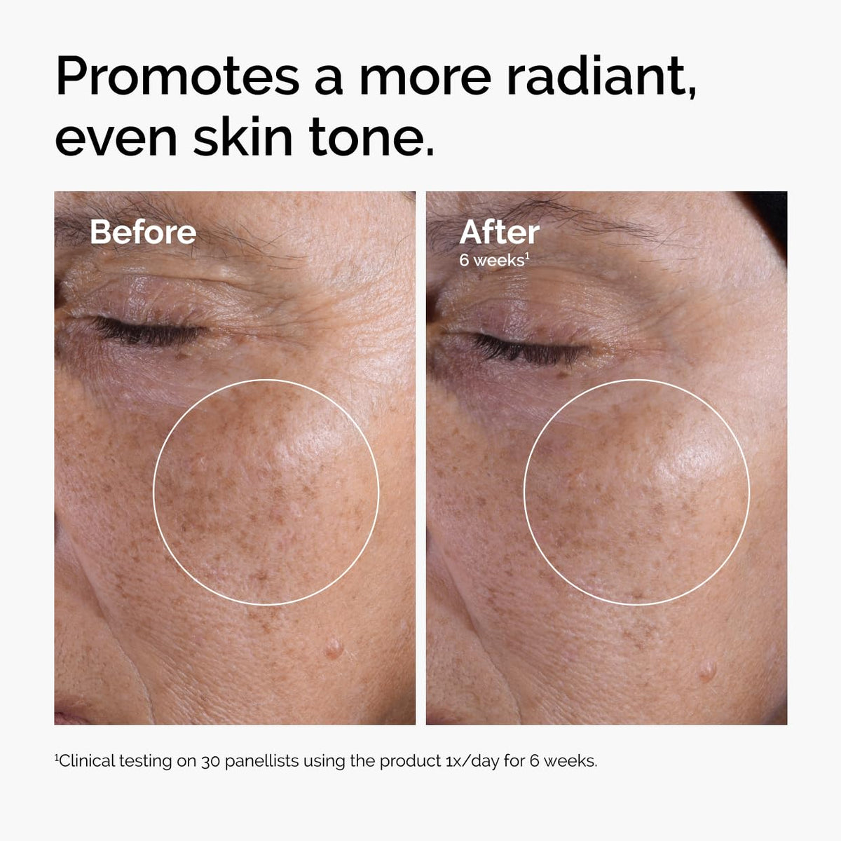 Glycolic Acid 7% Exfoliating & Brightening Toner (8.1 Fl Oz) | speso tech