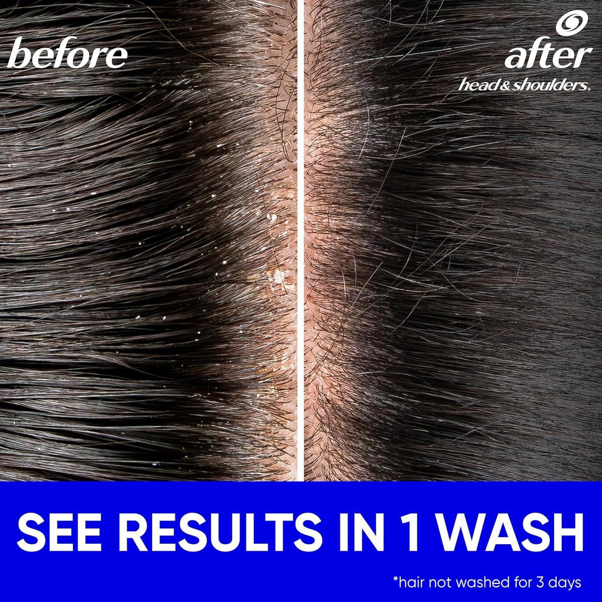 Head & Shoulders Classic Clean Anti-Dandruff Shampoo, 72-Hour Dandruff Protection, 1% Pyrithione Zinc, 28.2 fl oz